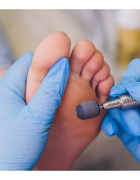 Vivofácil | Servicio de Podología